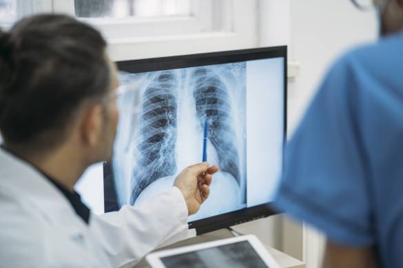 Image of doctor pointing at X-ray.
